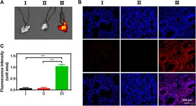 Nanoscale Porphyrin Metal-Organic Frameworks Deliver siRNA for Alleviating Early Pulmonary Fibrosis in Acute Lung Injury